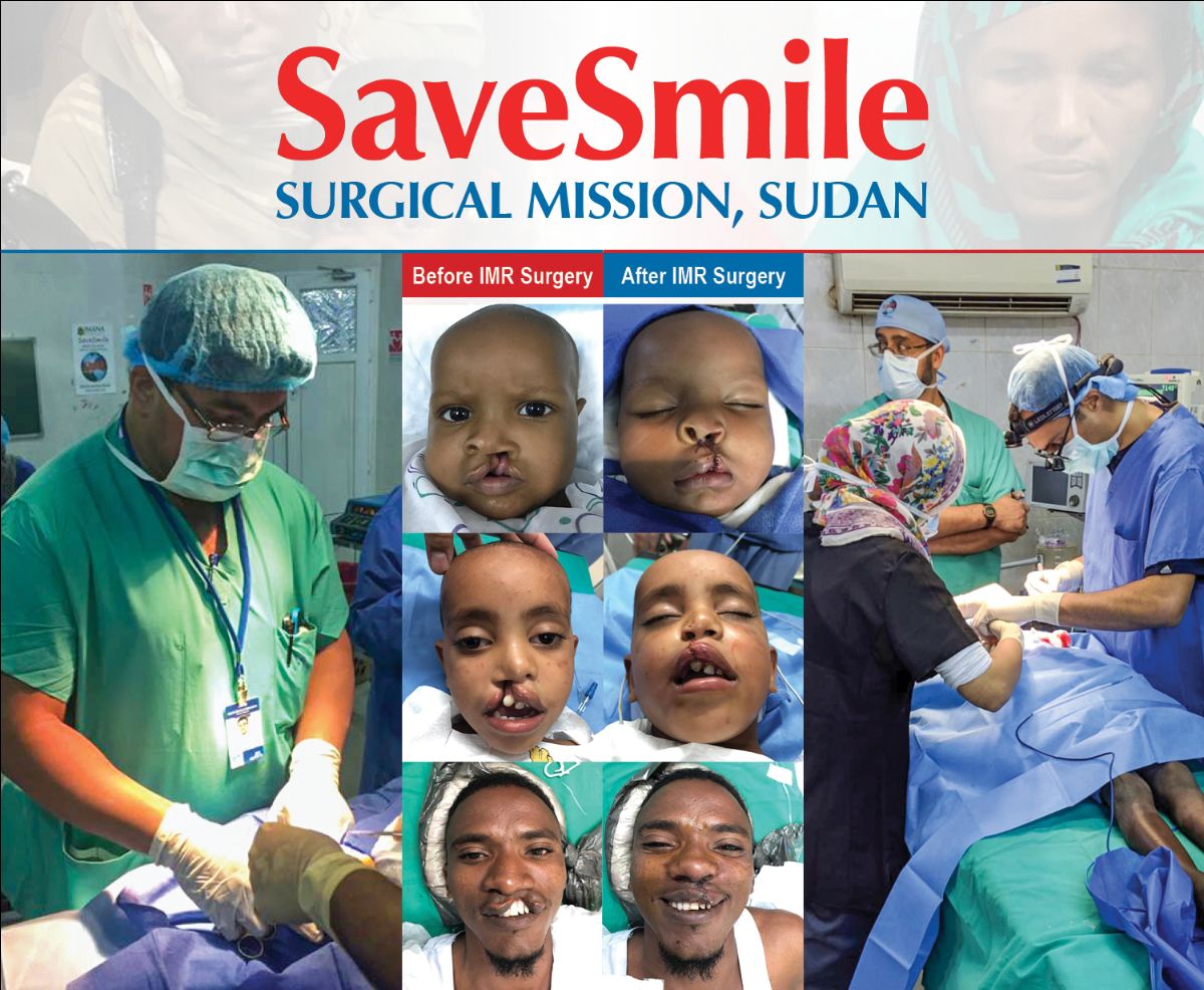 SaveSmile Surgical Mission – Cleft Lip Project in Sudan
